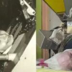 Muere la última paciente de polio de EE.UU. que usaba un pulmón de acero